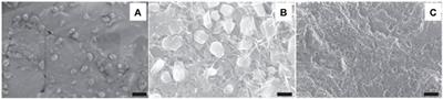 Pioneering nanomedicine in orthopedic treatment care: a review of current research and practices